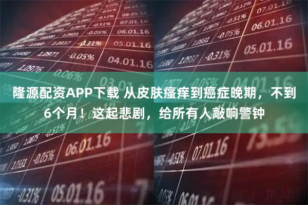 隆源配资APP下载 从皮肤瘙痒到癌症晚期，不到6个月！这起悲剧，给所有人敲响警钟